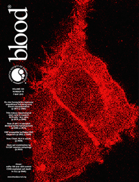 期刊發表論文 Science Journal: Blood - The American Society of Hematology 